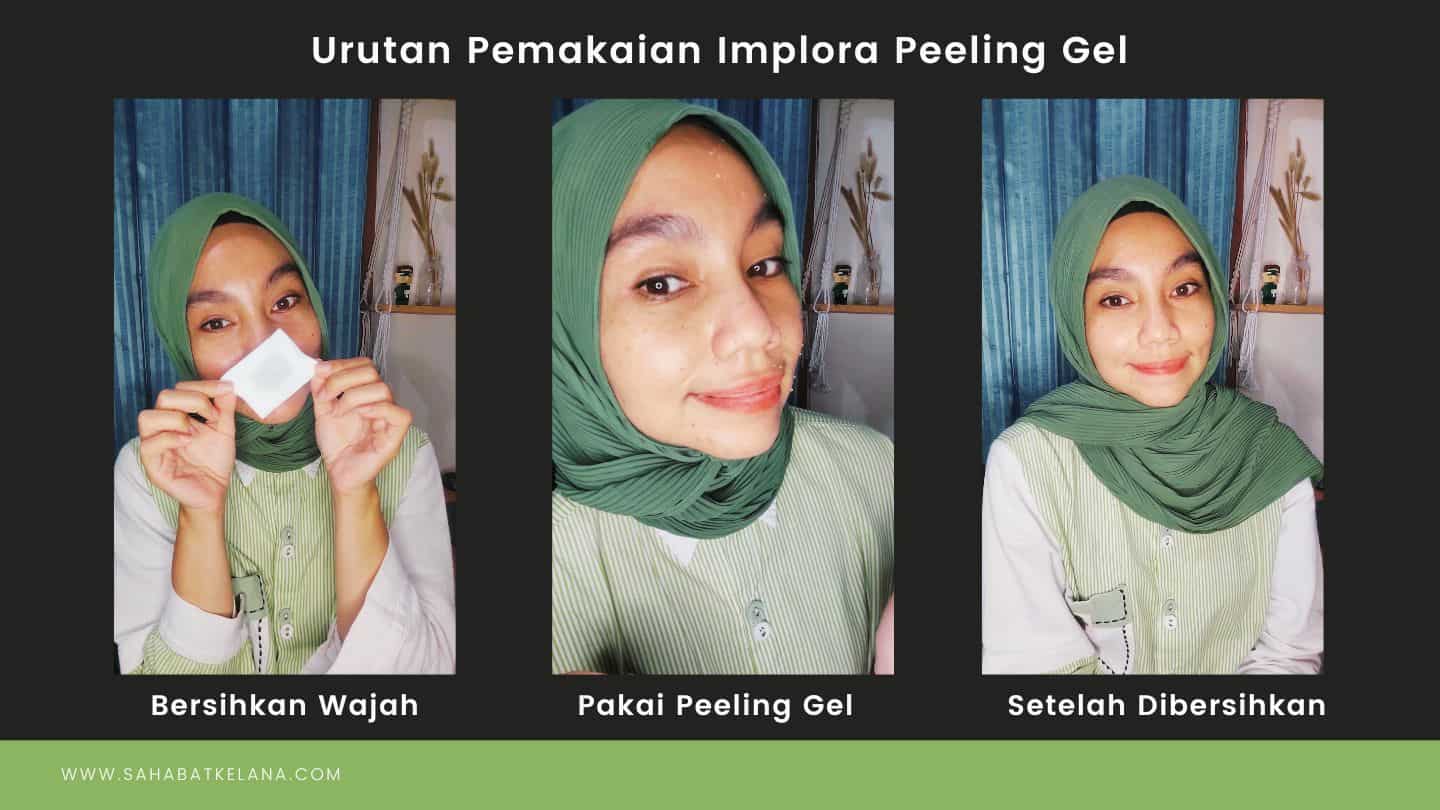Review Penggunaan Implora Peeling Gel